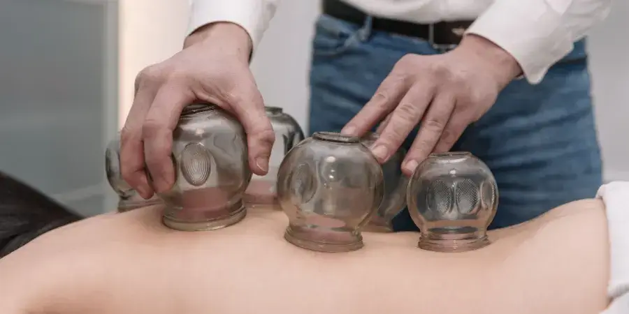 Conditions Treated within Chinese Cupping in Ottawa