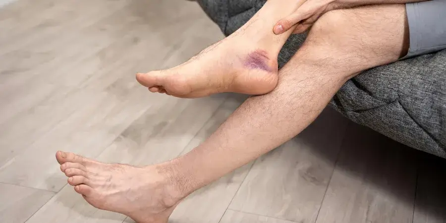 Treatment at Physiocare for Ankle Impingement