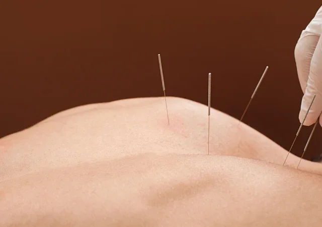 Why Your Nervous System Remembers Pain
