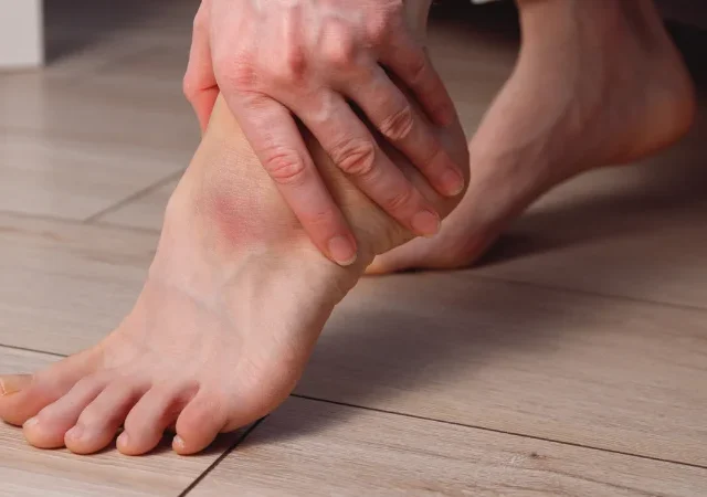 Plantar Fasciitis Treatment: Physiotherapy in Ottawa for Lasting Heel Pain Relief