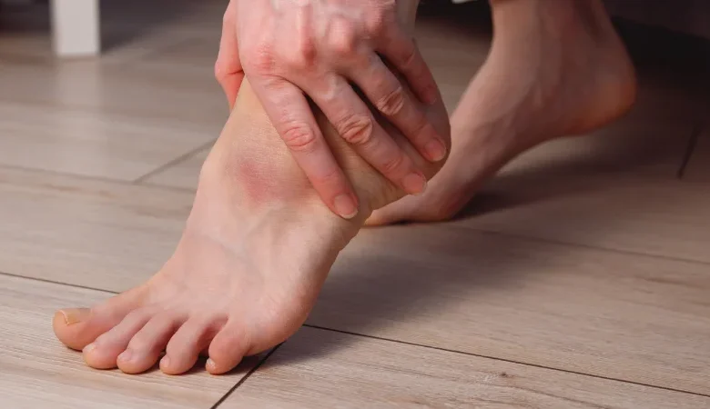 Plantar Fasciitis Treatment: Physiotherapy in Ottawa for Lasting Heel Pain Relief